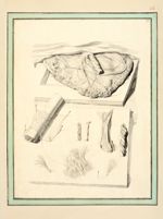 De haut en bas et de gauche à droite : Le placenta / Fragment du chorion / Fragment d'une artère omb [...]