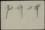 Fractures. 23 planches. Dessins originaux provenant de la bibliothèque du Dr Ph. J. Pelletan, chirur [...]