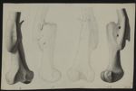 Fractures. 23 planches. Dessins originaux provenant de la bibliothèque du Dr Ph. J. Pelletan, chirur [...]