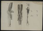 Pl. unique. Fig. I à Fig. VII - Observations chirurgicales. 23 dessins originaux (avec quelques repr [...]