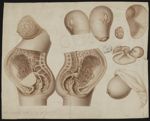 [Anatomie de la grossesse / représentation imprimée en sépia pour montage d'un atlas anatomique avec [...]