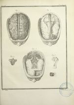 Fig. 1 à 5 : Représentation de la base du crâne revêtu de la dure-mère - Histoire naturelle, général [...]