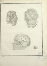 Fig. 1 à 3 : Représentation de la base du crâne revêtu de la dure-mère - Histoire naturelle, général [...]