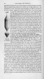 Aréomètre de Nicholson - Histoire naturelle des drogues simples, ou Cours d'histoire naturelle profe [...]