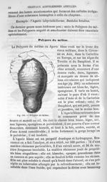 Polypore du Mélèze - Histoire naturelle des drogues simples, ou Cours d'histoire naturelle professé  [...]