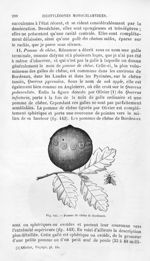 Pomme de chêne de Bordeaux - Histoire naturelle des drogues simples, ou Cours d'histoire naturelle p [...]