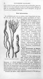 Ipécacuanha du Brésil - Histoire naturelle des drogues simples, ou Cours d'histoire naturelle profes [...]