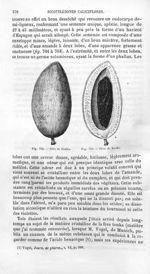 Fève de Tonka - Histoire naturelle des drogues simples, ou Cours d'histoire naturelle professé à l'É [...]