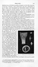 Trichina spiralis - Histoire naturelle des drogues simples, ou Cours d'histoire naturelle professé à [...]
