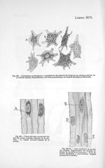 Fig. 168. Variedades morfológicas y cuantitativas del retículo de Golgi de las células motríces de l [...]