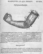 Description du bras de fer - Les oeuvres d'Ambroise Paré... divisées en vingt huit livres