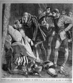 Ambroise Paré arrachant de la blessure de Henri II le fer de la lance du sire de Montgomery