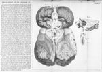 Base du cerveau dépouillé de tous ses vaisseaux - Traité de l'organe de l'ouïe