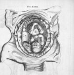 [Accouchement : présentation de l'enfant par la tête (le cordon passe derrière la nuque)] - Anatomia [...]