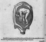 De la situation de l'enfant au ventre de la mère - Les oeuvres d'Ambroise Paré... divisées en vingt  [...]