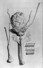 Fig. 1. Ureteris dissecta atque expansa portiuncula / Fig. 2. Ureteres, vesica urinaria et penis - A [...]