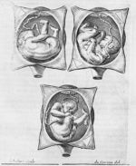 [Différentes positions du foetus lors de l'accouchement : présentation par le dos, par une épaule et [...]
