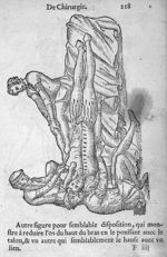 Figure qui monstre à réduire l'os du haut du bras - Dix livres de la chirurgie avec le magasin des i [...]