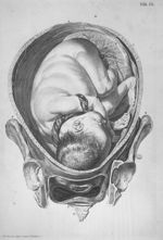 [Position de l'enfant avant l'accouchement] - Tabulae anatomicae