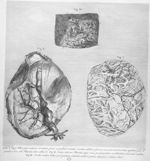 Anatomia uteri humani gravidi tabulis illustrata