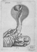 [Manière de décoller le placenta resté dans l'utérus] - Le chemin fraye et infaillible aux accouchem [...]