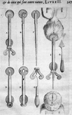 [Accouchement : instruments utilisés pour tirer l'enfant par la tête] - Traité des maladies des femm [...]