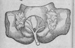 [Expulsion du placenta] - De integritatis et corruptionis virginum notis ; graviditate... et partu n [...]