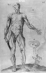 [Écorché vu de face. Muscles du corps humain] - L'anatomie universelle de toutes les parties du corp [...]