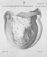 Figure représentant l'intérieur du ventricule gauche, par M. Portal - Traité de la structure du coeu [...]