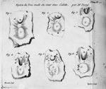Figure du trou ovale du coeur dans l'adulte, par M. Portal - Traité de la structure du coeur, de son [...]
