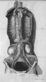 [Vaisseaux lymphatiques du thorax] - An inquiry into the nature and cause of that swelling, in the l [...]