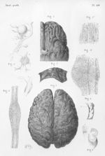 Atlas d'anatomie pathologique