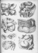 Cas variés d'étranglements intestinaux - Traité complet de l'anatomie de l'homme comprenant la médec [...]