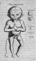 Fetus de trois mois - Traité des maladies des femmes grosses et et de celles qui sont accouchées; ob [...]