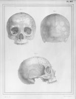 [Protubérances du crâne données par M. le docteur Gall, comme pouvant servir à faire reconnaître les [...]