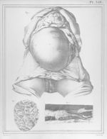 [Utérus d'une femme morte à la fin du neuvième mois de la grossesse] - Manuel d'anatomie descriptive [...]