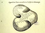 Figure d'une pierre extraitce à un pastissier de Montargis - Les oeuvres d'Ambroise Paré... divisées [...]