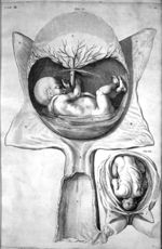 [Foetus humain dans l'utérus et position qu'il prend avant l'accouchement] - De formato foetu