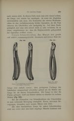 [Fig.193. Pinces pour les molaires de la mâchoire supérieure / Fig.194. Pince pour les dents de sage [...]