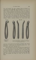[Fig.197. Pince pour les molaires utilisable pour les deux côtés / Fig.198. Pinces pour les molaires [...]