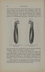 [Fig.36. Pince d'Iszlai pour les molaires inférieures droites / Fig.37. Pince d'Iszlai pour les mola [...]