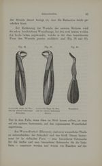 [Fig.38. Pince d'Iszlai pour les racines des molaires inférieures droites / Fig.39 pince d'Iszlai po [...]