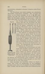 [Fig.212. Forets en forme de béquilles pour les canaux des racines] - Lehrbuch der Zahnheilkunde für [...]