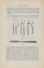 [Fig.83 à 88. Fouloirs / Fig.89. Spatule] - Compendium der Zahnheilkunde für Studirende und Ärzte