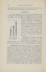 [Fig.90. Lancette / Fig.91. Foret à fissurer / Fig.92. Trépan] - Compendium der Zahnheilkunde für St [...]