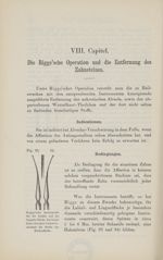 [Fig.93 et 94. Instruments de Riggs pour les zones labiale et linguale] - Compendium der Zahnheilkun [...]