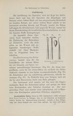 [Fig.95 à 97. instruments pour écarter les dents] - Compendium der Zahnheilkunde für Studirende und  [...]