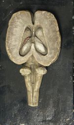 Encéphale du cheval - coupe horizontale passant par les ventricules latéraux