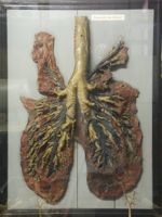 Poumons du cheval, disséqué, montrant les artères et les veines pulmonaires injectées