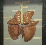 Poumons du boeuf, disséqué, montrant les artères et les veines pulmonaires injectées